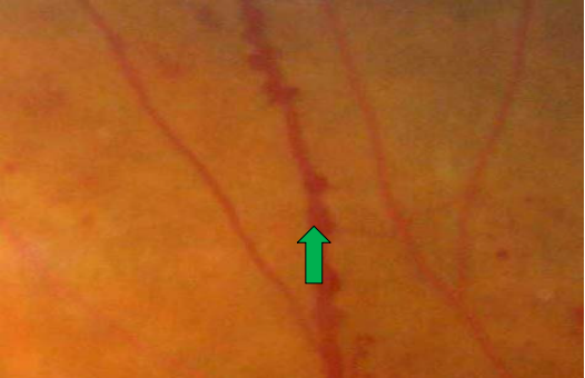 2025123009142500.png image.png