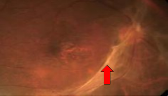 2025123009151104.png image.png